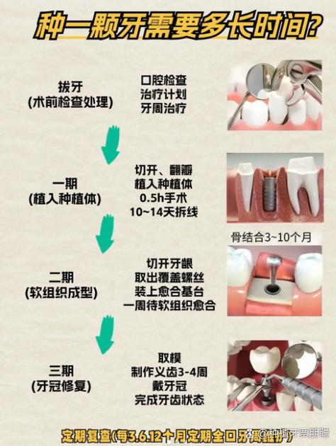 种牙ct怎么看_种植牙ct的设计方案过程_ct种牙价格