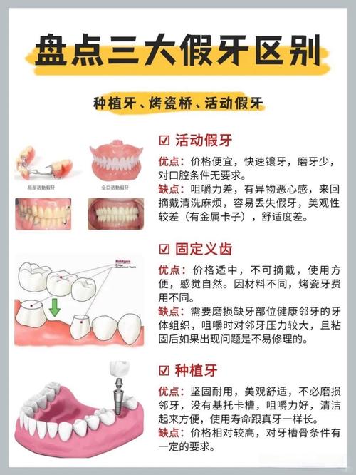 牙齿脱落一颗种牙多少钱_牙齿脱落 种牙_脱落的牙齿可以种回去吗