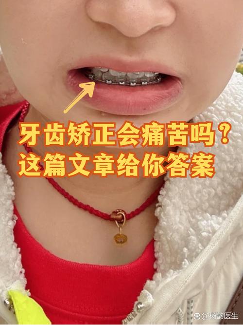 牙齿矫正做可以用医保吗_19岁可以做牙齿矫正吗_牙齿矫正能