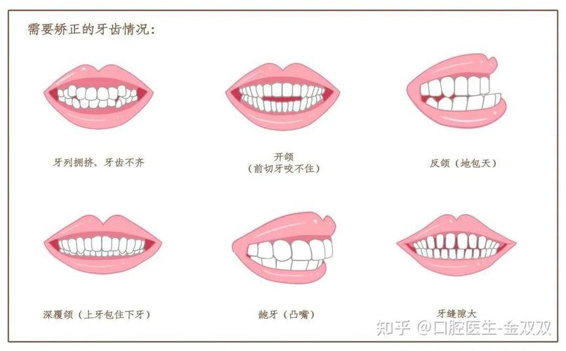 成人牙齿矫正费用大概多少_成人如何牙齿矫正_成人牙齿矫正需要多久时间