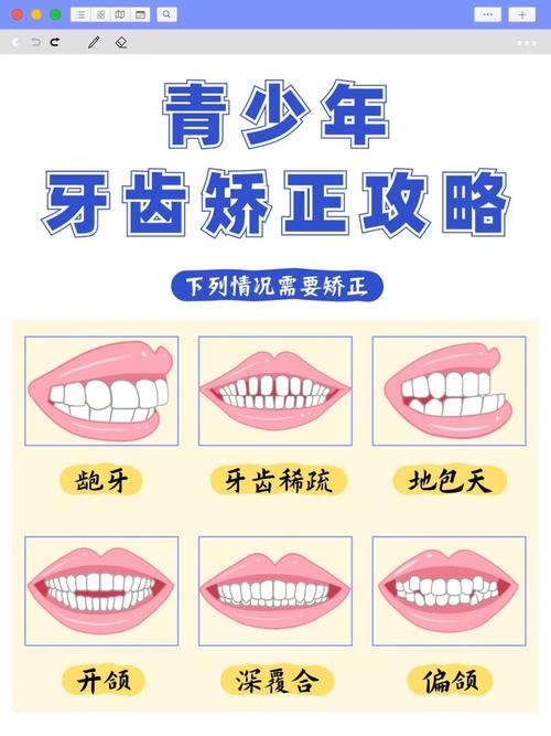 15岁牙齿不齐如何纠正_比较整齐的牙齿矫正会便宜点吗_牙齿矫正对齐