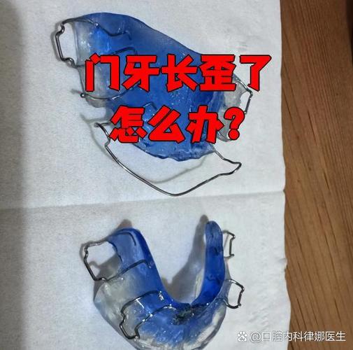 牙齿长歪了怎么矫正?多少钱能搞定?