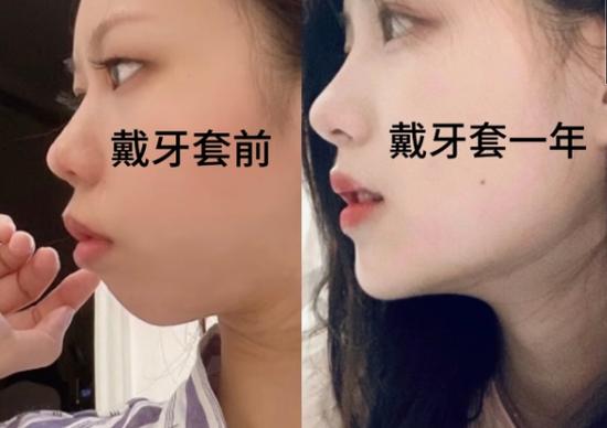 郴州做牙齿矫正哪家好?看完这篇不踩坑