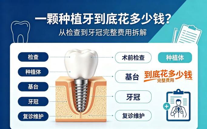 去口腔医院种一颗牙得花多少钱？详细拆解告诉你