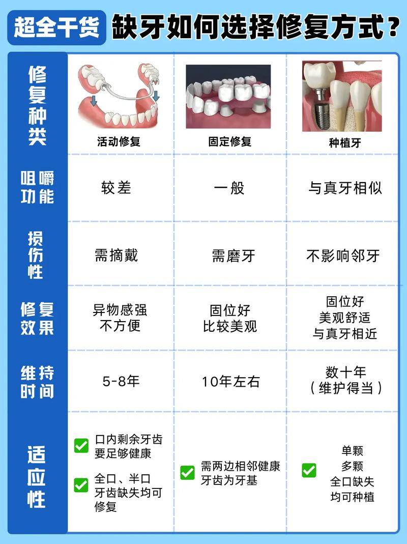 补牙镶牙种植牙的区别_补牙种牙镶牙_补牙镶牙种牙