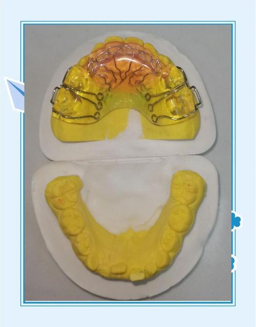 12岁牙齿矫正器有哪几种_牙齿矫正器种有几种_牙齿矫正器种类