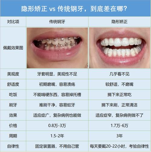 成人做牙齿矫正_成人牙齿矫正收费_成人矫正牙齿大概多少钱
