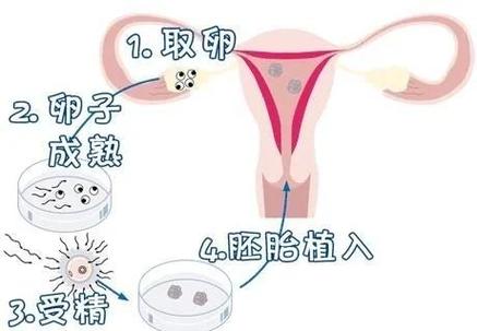 三代试管基因筛选费用_试管哪个医院可筛选基因做的好_三代试管可以筛选基因吗
